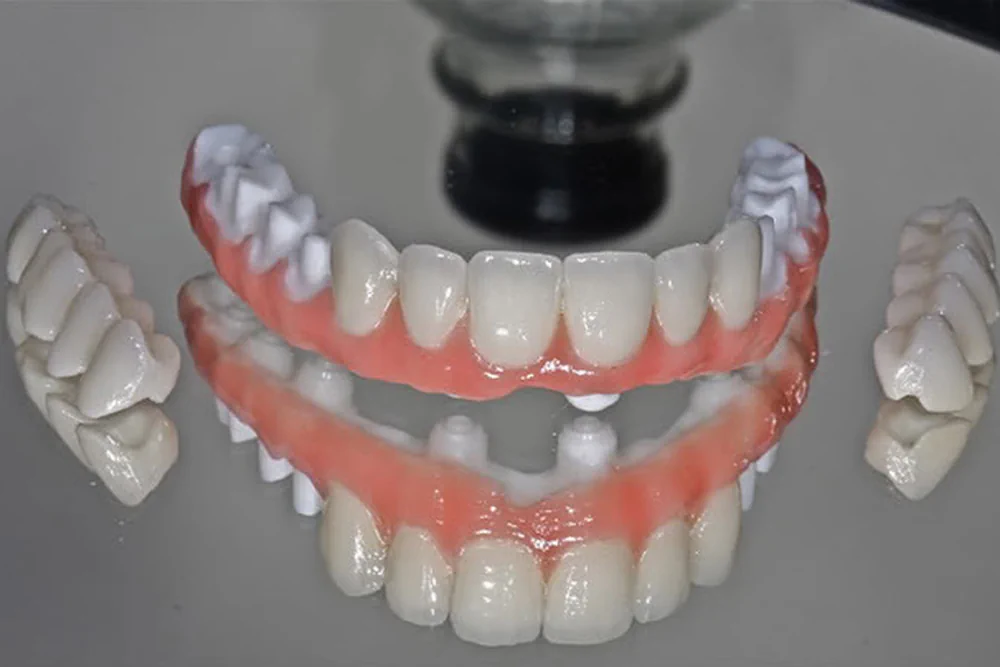 Беззубые челюсти. Цельноциркониевая балка.